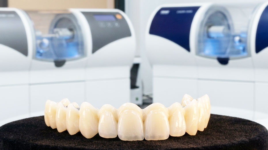Material Comparison: Why Zirconia is the 2026 Gold Standard