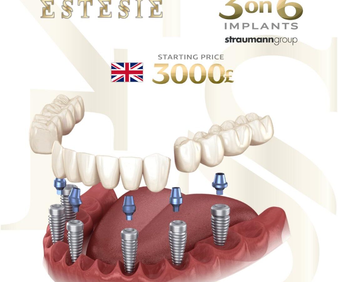 3 on 6 implants